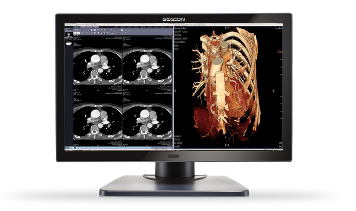 巨烽C61W+6MP一体化双屏显示器_报价_参数