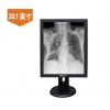 安立信PACS阅片医用显示器